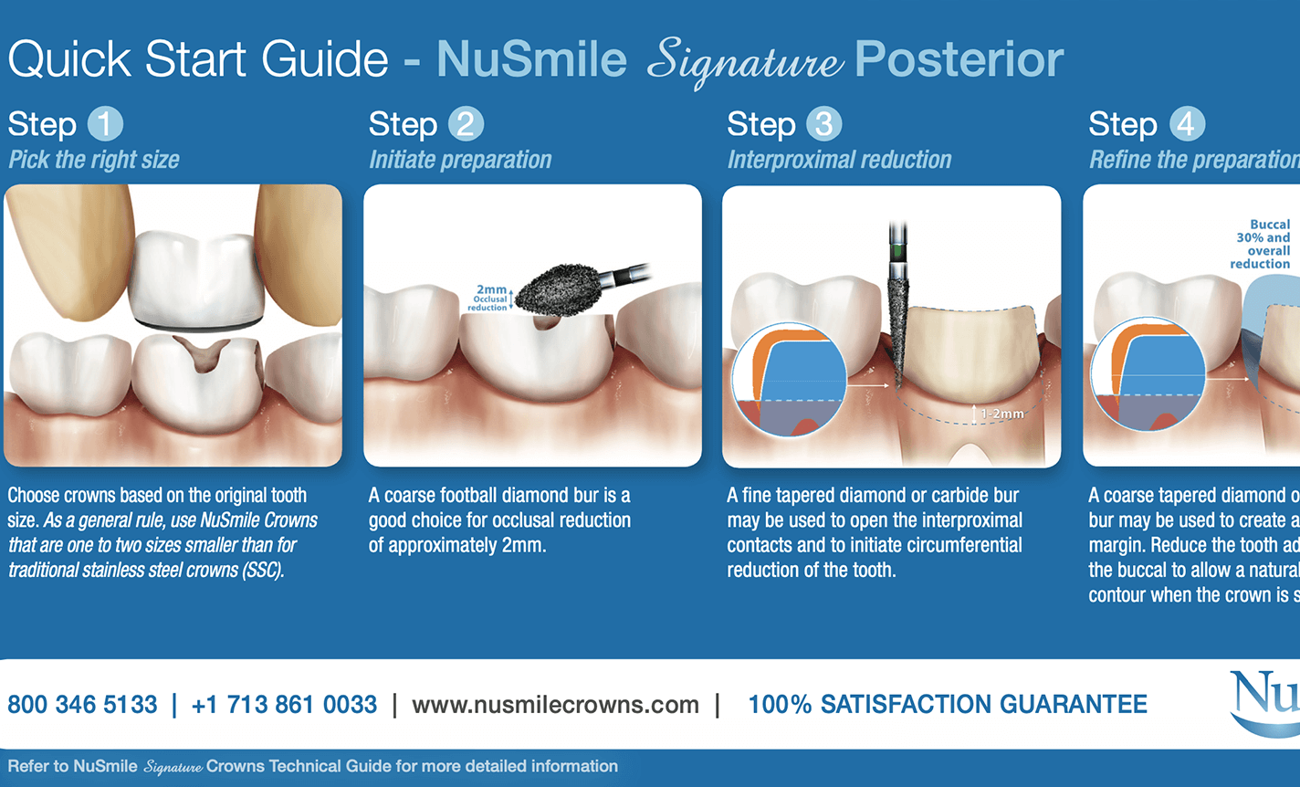 NuSmile Signature Quick Start Guide - Posterior