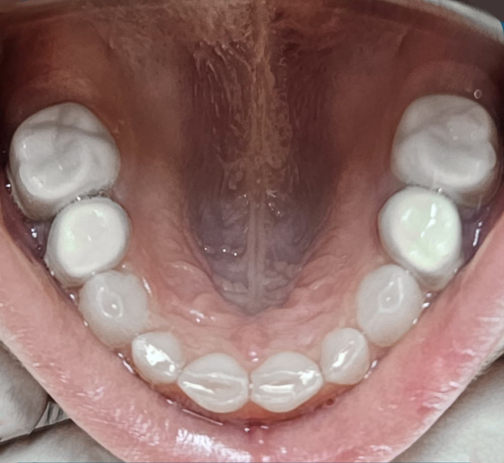 BioFlx clinical case by Maia Ayoub