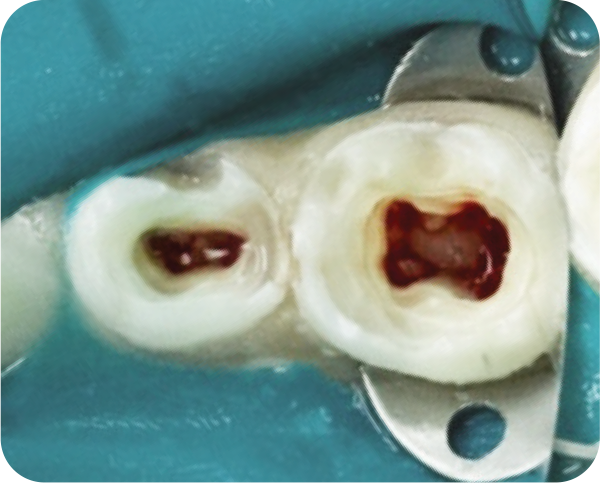 NeoPUTTY isolate and control step image one