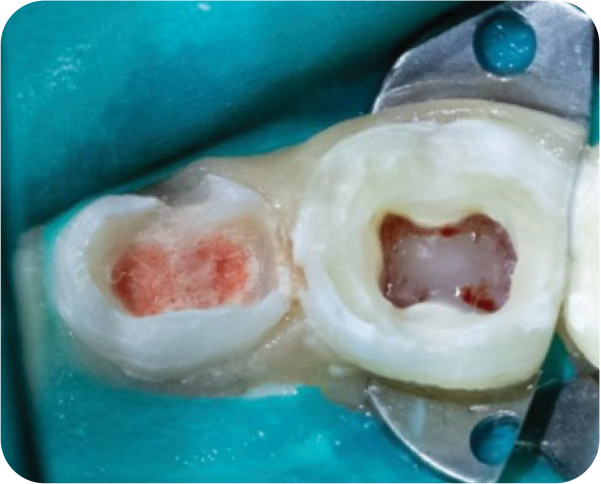 NeoPUTTY isolate and control step image two