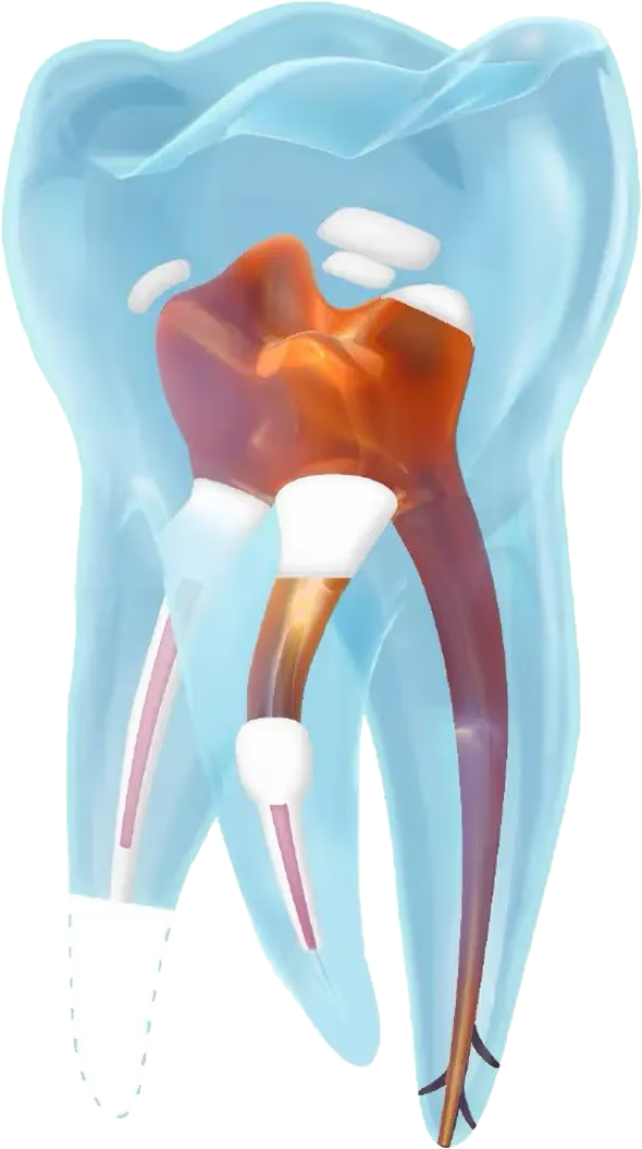 NeoPUTTY Indications for Use