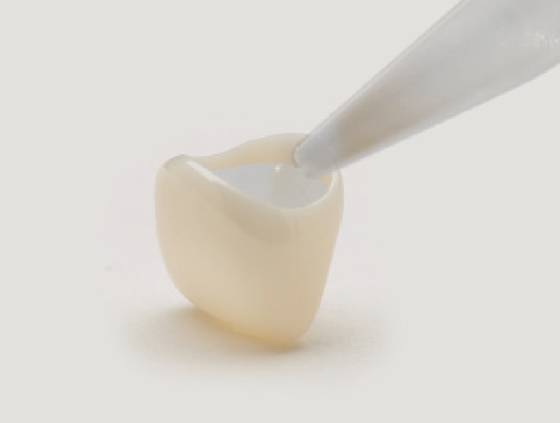 Dispensing NuCem into crown
