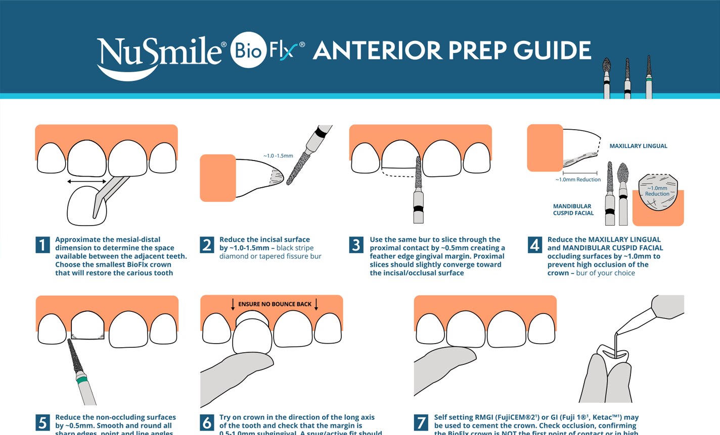 NuSmile BioFlx Anterior Quickstart