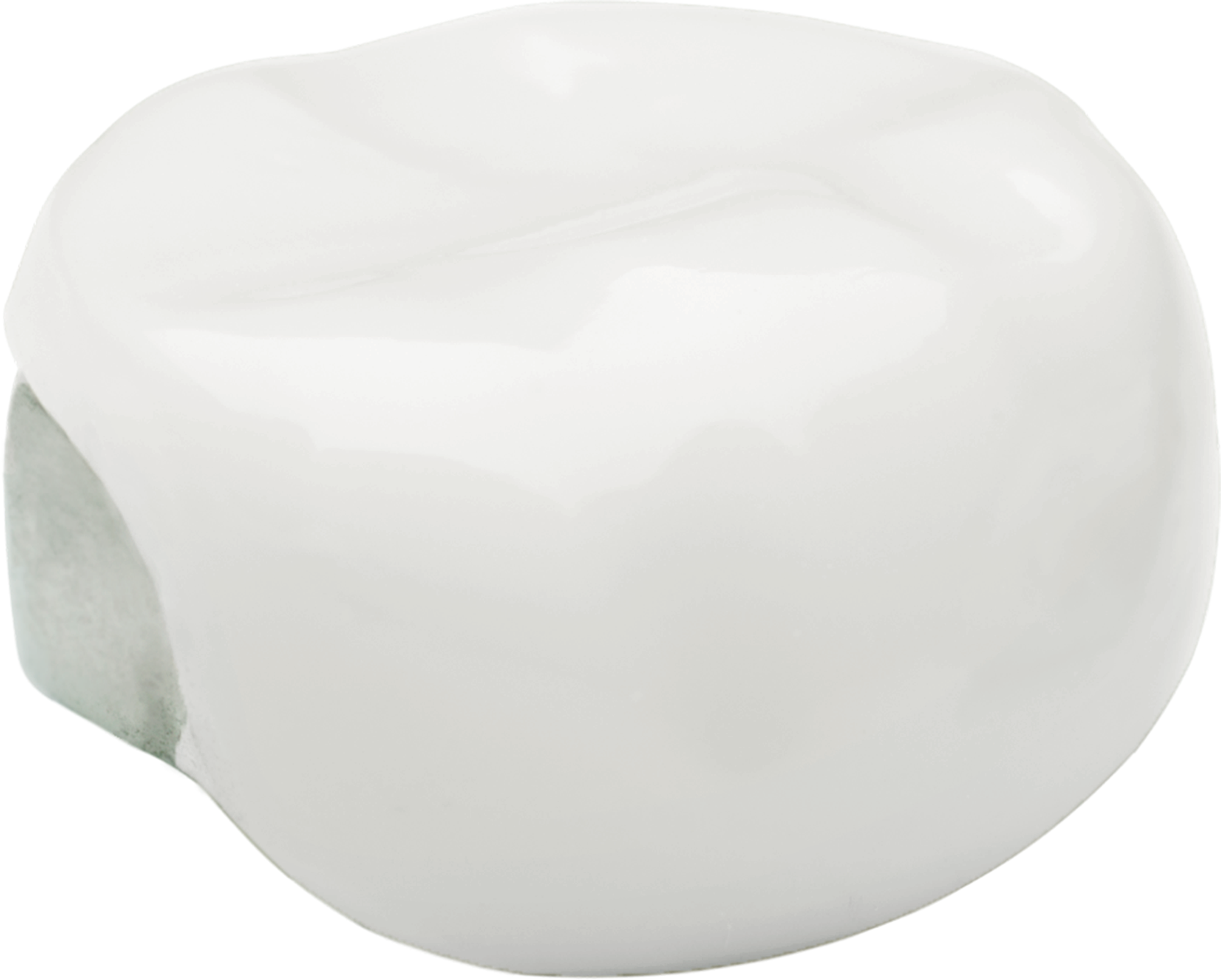 NuSmile Signature Posterior Crown